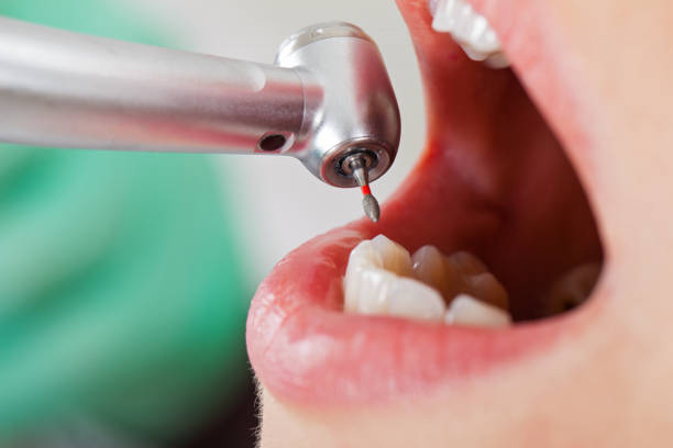 Best Emergency Dental Services for Seniors in Patterson, LA